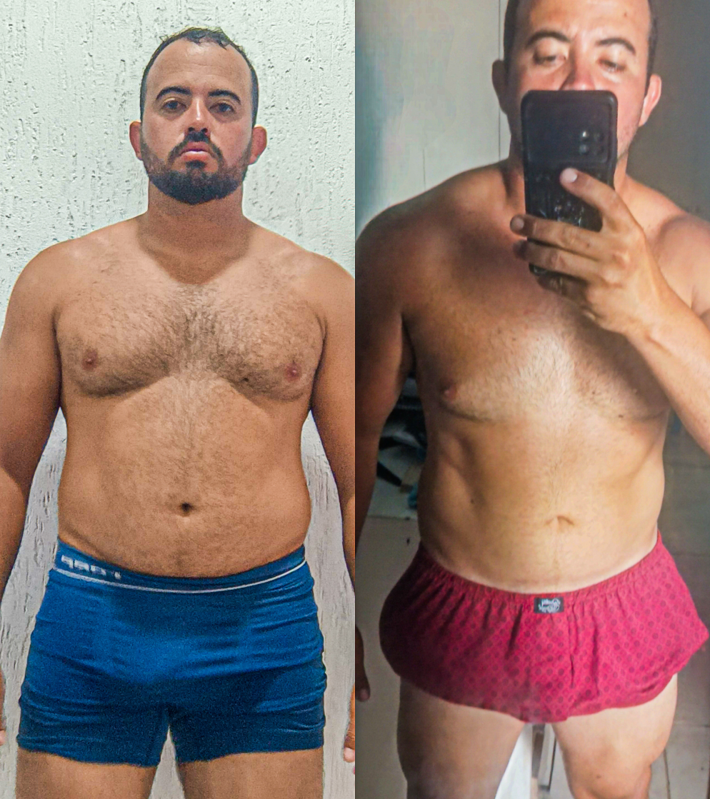André Lucas Santiago - antes e depois