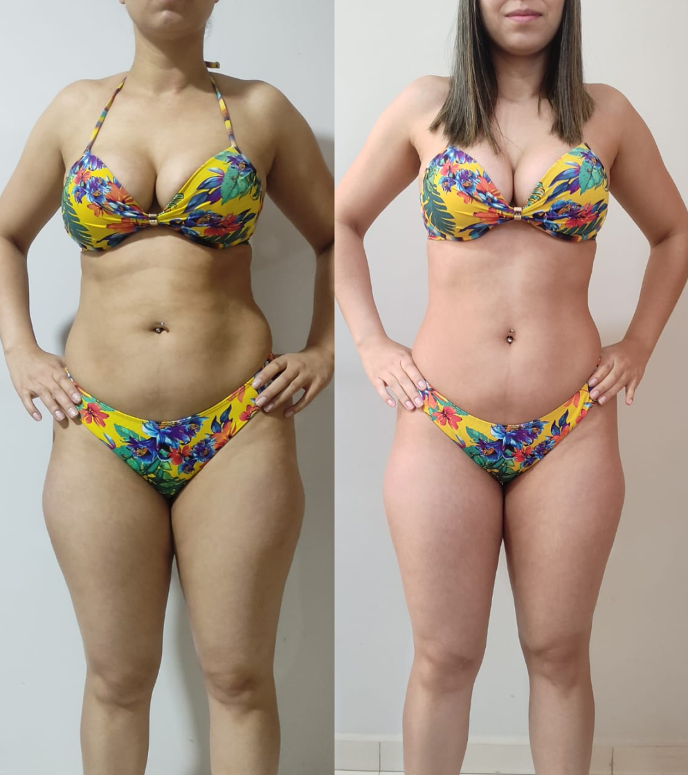 André Lucas Santiago - antes e depois