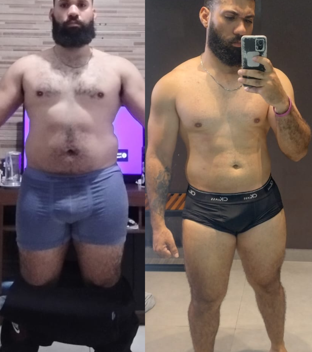 André Lucas Santiago - antes e depois