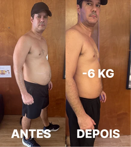 Camila Guerra - antes e depois